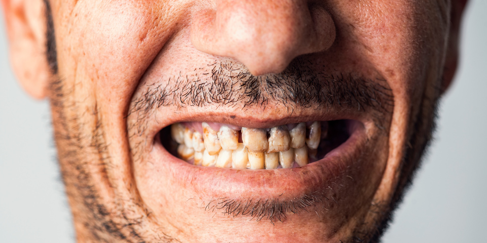 Can having bad teeth affect your overall health? - PostMyMeds
